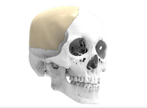 20250430102245